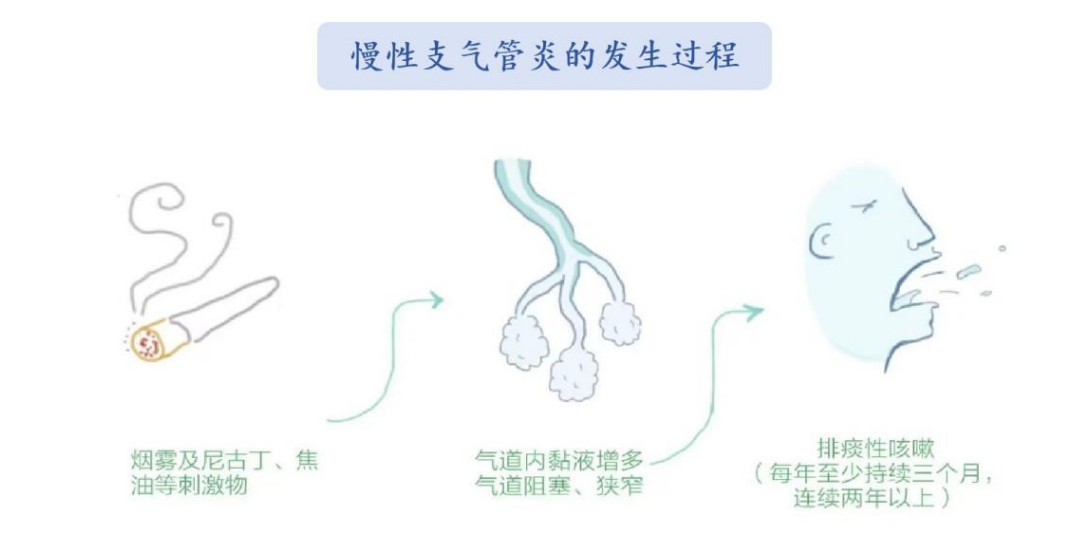 纤毛细胞带你看“慢支”