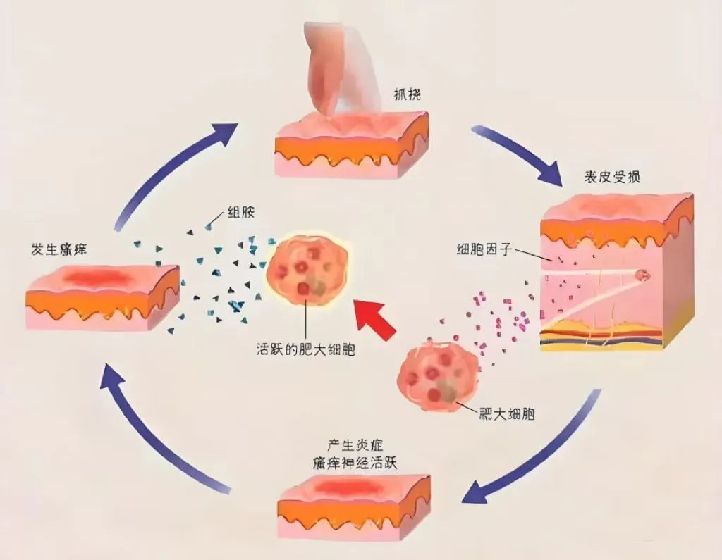 警惕！炎症可能变癌症！这样做可消炎