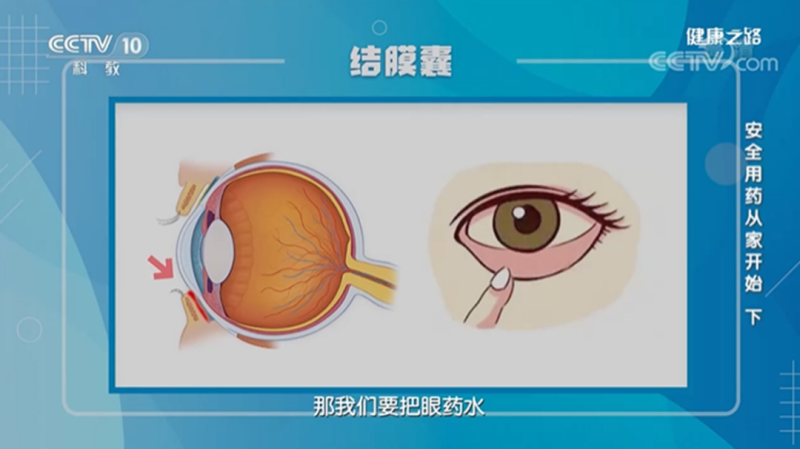 视力仅剩0.1！这样的眼药水不能用！