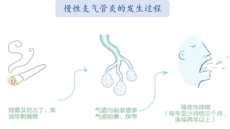 纤毛细胞带你看“慢支”