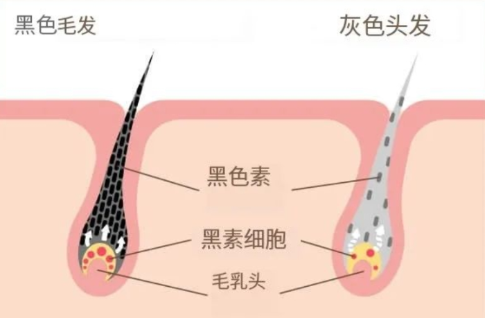 头发白了，还能变黑吗？医生的答案出乎意料